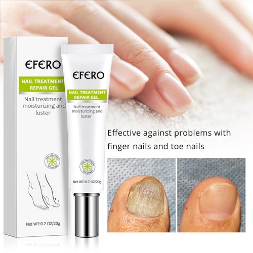 Fungal Removal Nail Treatment - Image 2