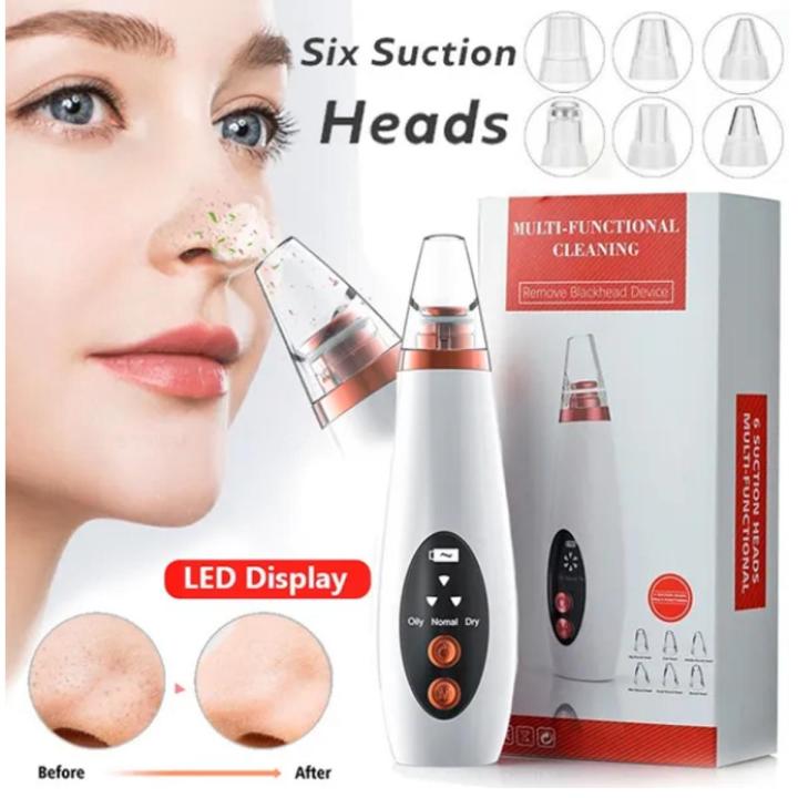 Blackhead Remover Machine - Image 4